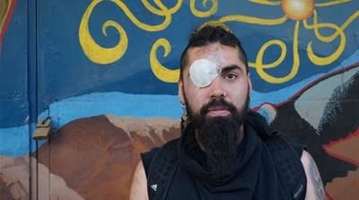 Marcelo Herrera was injured when a projectile hit his eye during the protests