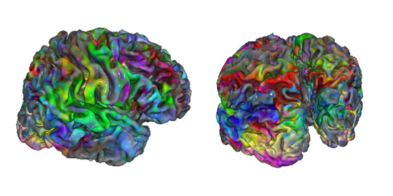 Some scientists believe AI could be used in the future for detecting diseases such as Alzheimer’s [Yu Takagi]