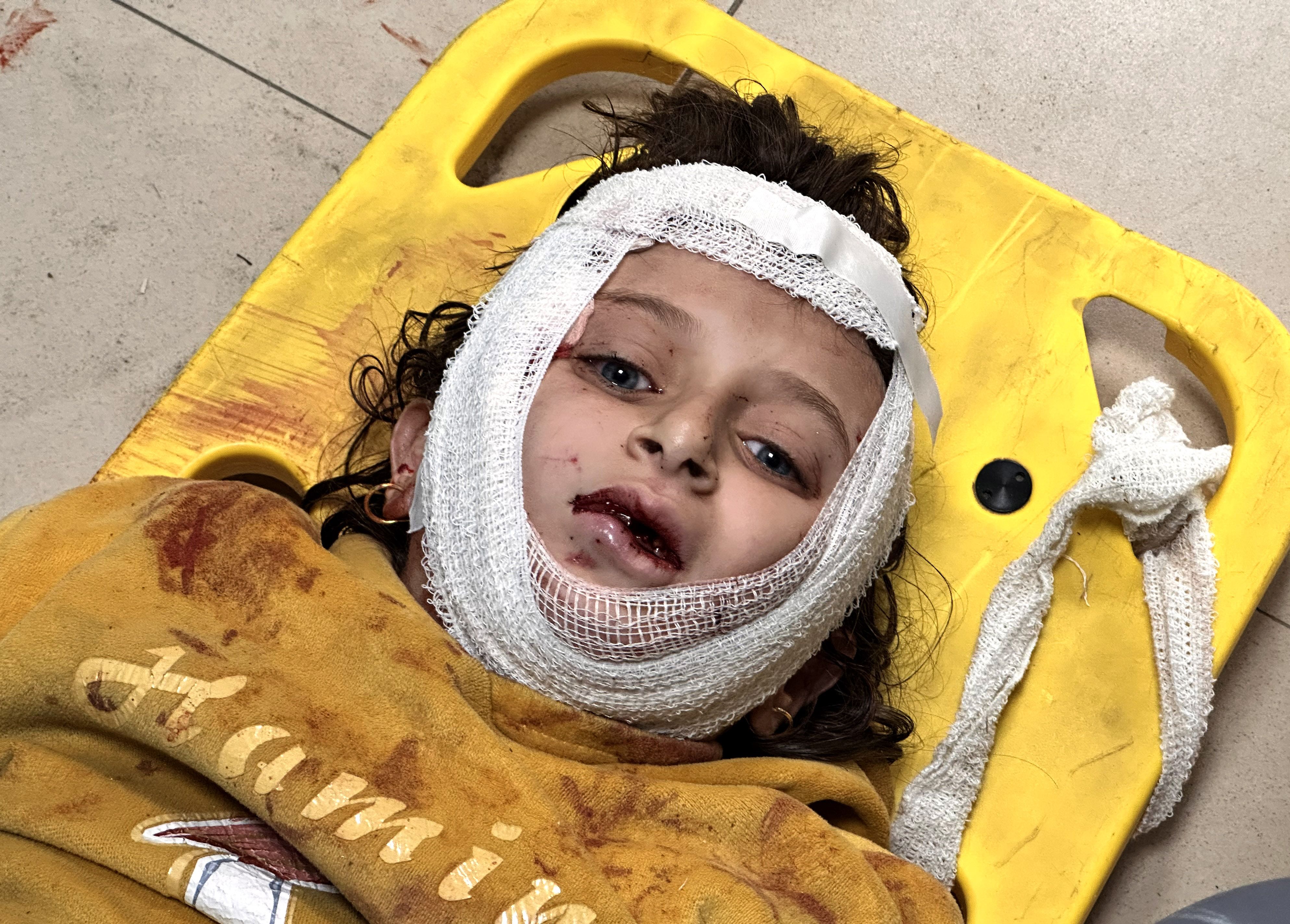An injured Palestinian girl is taken to Al-Aqsa Martyrs Hospital for medical treatment following Israeli army hit Nasirat Refugee Camp in Deir al-Balah, Gaza.