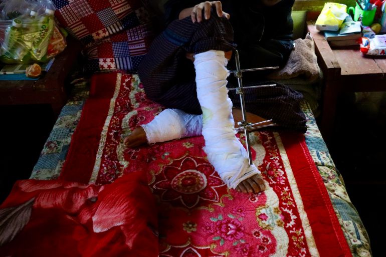 A resistance fighter injured by a landmine gets treatment at a clandestine hospital in Kayah