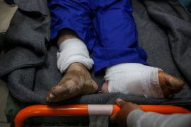 Mohammed Al-Torok, a newly released Palestinian who was detained by the Israeli army and said he was tortured in the Israeli detention, receives treatment at a hospital in Rafah in the southern Gaza Strip May 2, 2024. [Hatem Khaled/Reuters]