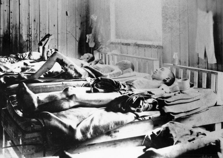 Survivors of the atomic explosion at Hiroshima in 1945 suffered long-term effects from radiation