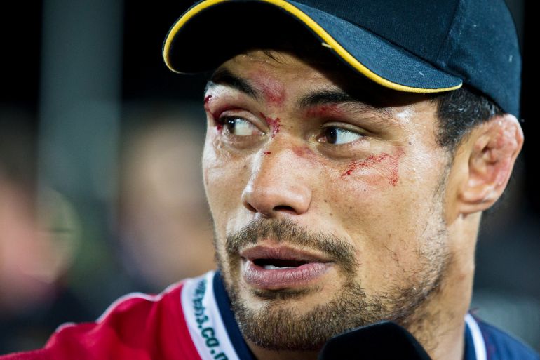 Shane Christie reported several concussions during his playing career [File: Alden Williams/Stuff via AP]